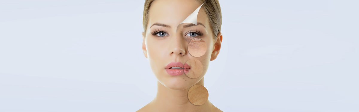 DULL SKIN – Looks Kart